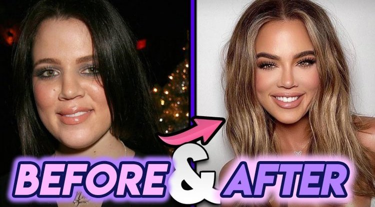 Khloé Kardashian finally admitted that she had plastic surgery!