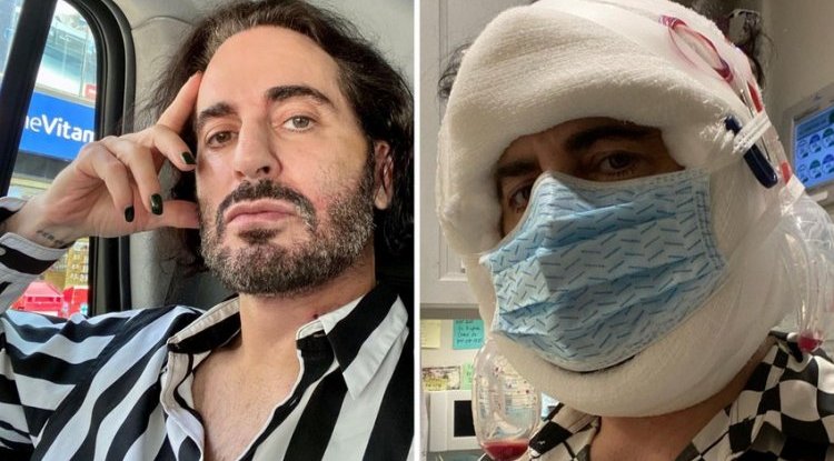 Designer Marc Jacobs underwent a facelift