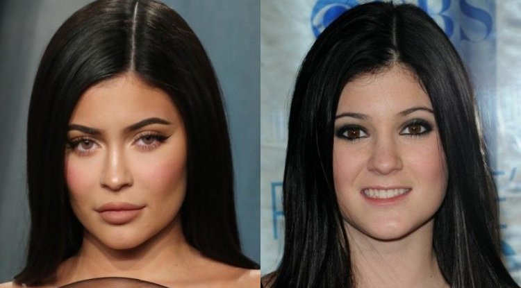 From a withdrawn girl to a sexy woman: Kylie Jenner celebrates her 24th birthday!