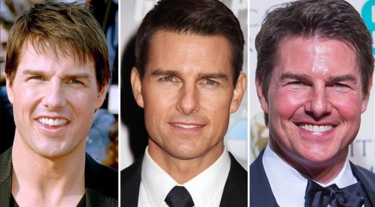 'What did he do with his face?' Tom Cruise's face looks like it's going to explode from all the Botox