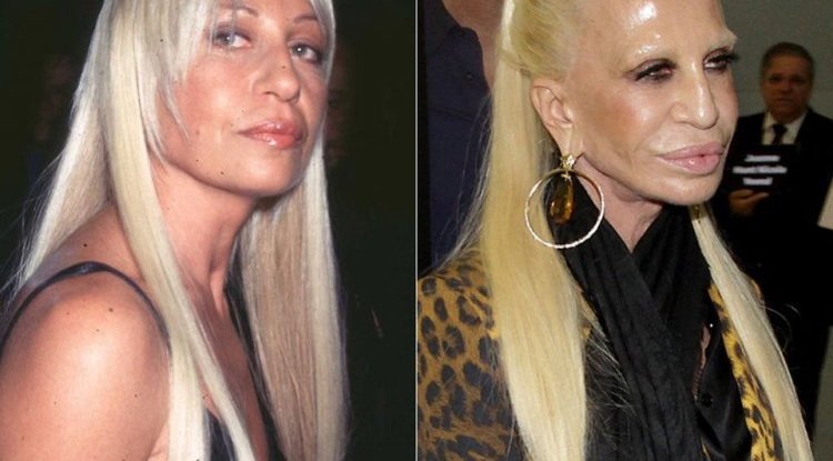Donatella Versace and her constant struggle to look 30, but is it working?