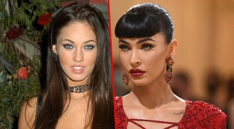 Megan Fox claims that she did not do any plastic surgery, but the old photo shows otherwise