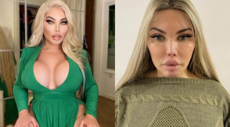 She can't breathe through her nose, or blink: Once a "human Ken", and "Barbie" today is falling apart due to more than 100 surgeries