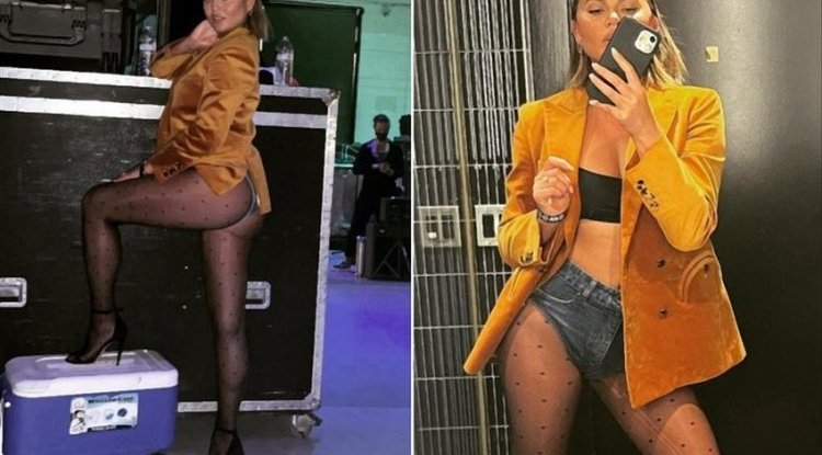Sexy accident / Chrissy Teigen showcases her drop-dead booty 'First one to tell me my tights are ripped wins'