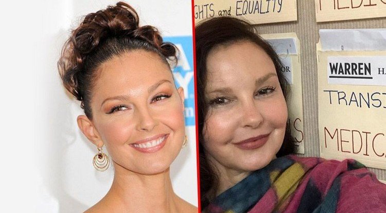 Ashley Judd was attacked for Botox, and the truth behind the aesthetic procedures is not pleasant at all