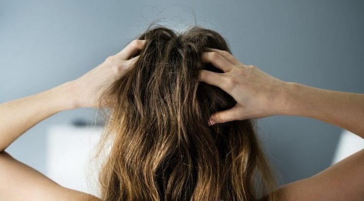 Do you know that feeling when your 'hair hurts'? There is an explanation