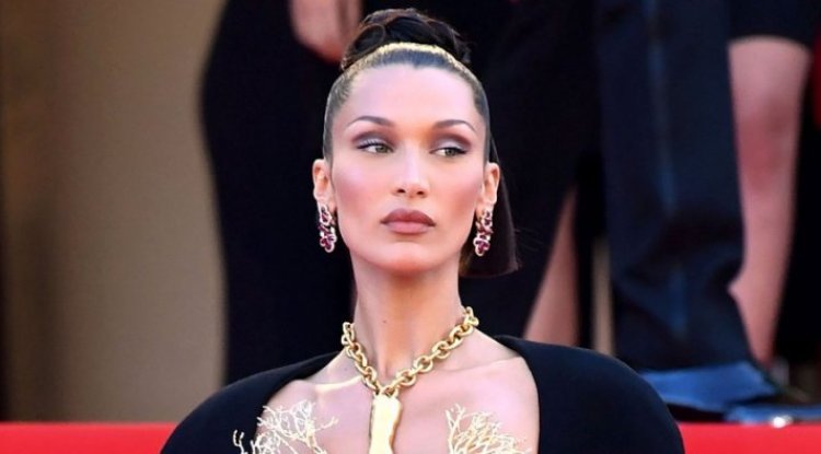 Behind the glamorous life, there is a difficult life story: Bella Hadid has been suffering from this disease since childhood!
