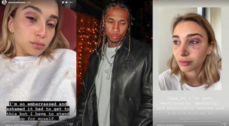 Kylie Jenner's ex boyfriend arrested for domestic violence, the girl posted disturbing pictures: 'I don't mean to hide it anymore'