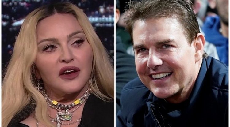 Aesthetic surgeon explains what actually happened Madonna's and Tom Cruise's faces