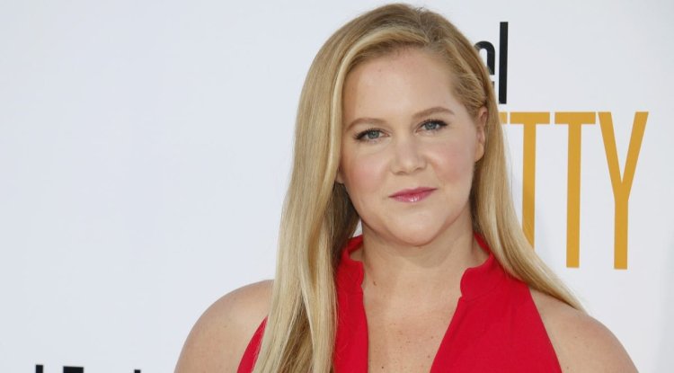 Amy Schumer took out her fillers!