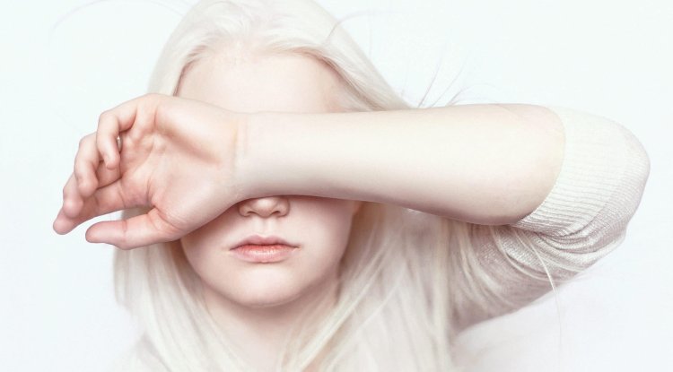 Cruel: Model left in an orphanage as a baby!