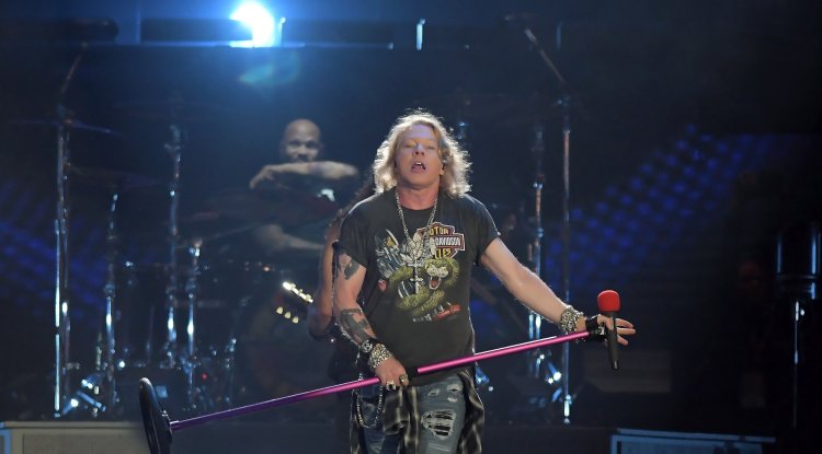 What happened to Axl Rose's face?