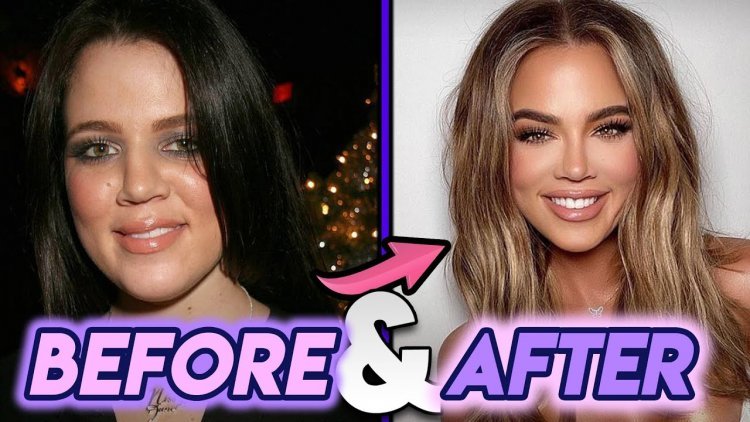 Khloé Kardashian finally admitted that she had plastic surgery!