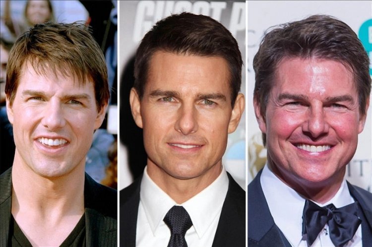 'What did he do with his face?' Tom Cruise's face looks like it's going to explode from all the Botox