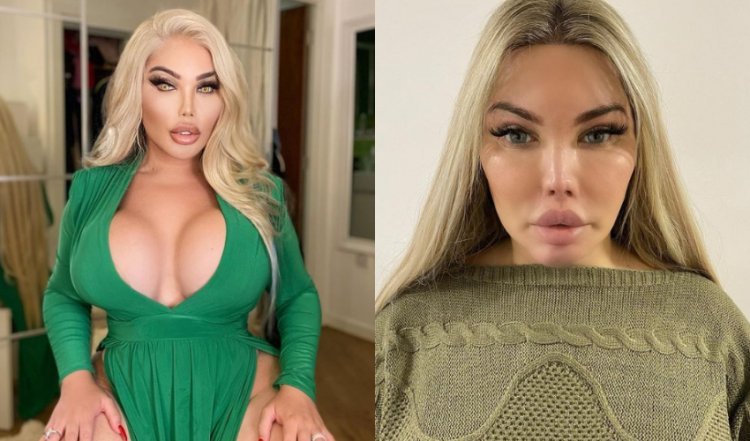 She can't breathe through her nose, or blink: Once a "human Ken", and "Barbie" today is falling apart due to more than 100 surgeries