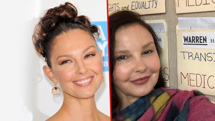 Ashley Judd was attacked for Botox, and the truth behind the aesthetic procedures is not pleasant at all
