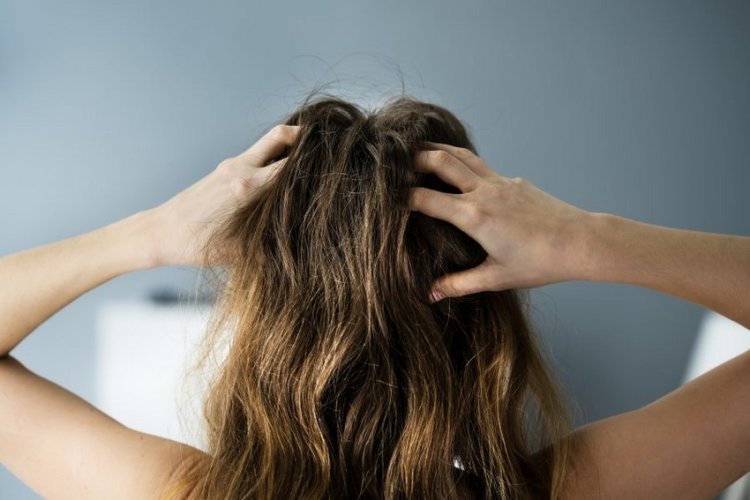 Do you know that feeling when your 'hair hurts'? There is an explanation