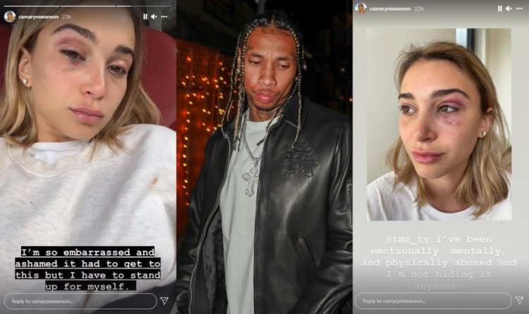 Kylie Jenner's ex boyfriend arrested for domestic violence, the girl posted disturbing pictures: 'I don't mean to hide it anymore'
