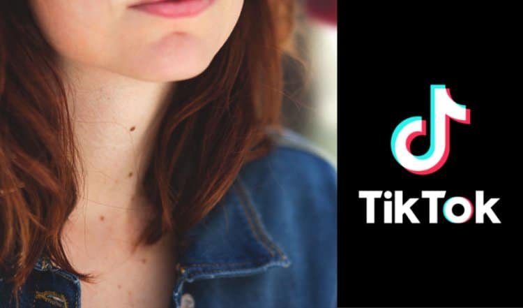 A new bizarre trend on TikTok: Users remove their own moles