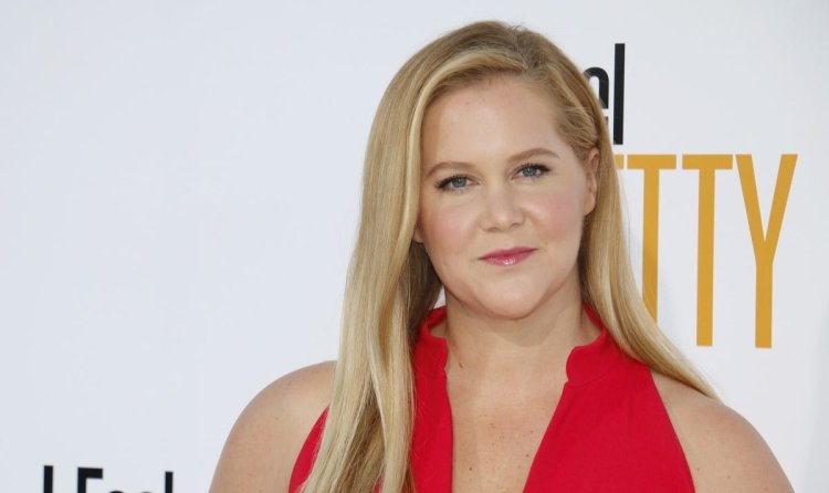 Amy Schumer took out her fillers!