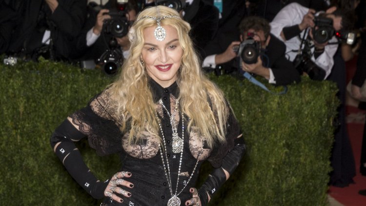 Madonna worried fans with her bruises!