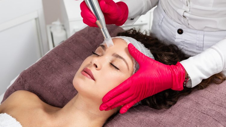 All you need to know about microneedling!