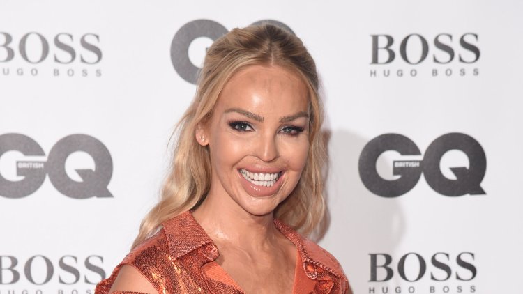 Katie Piper survived an acid attack